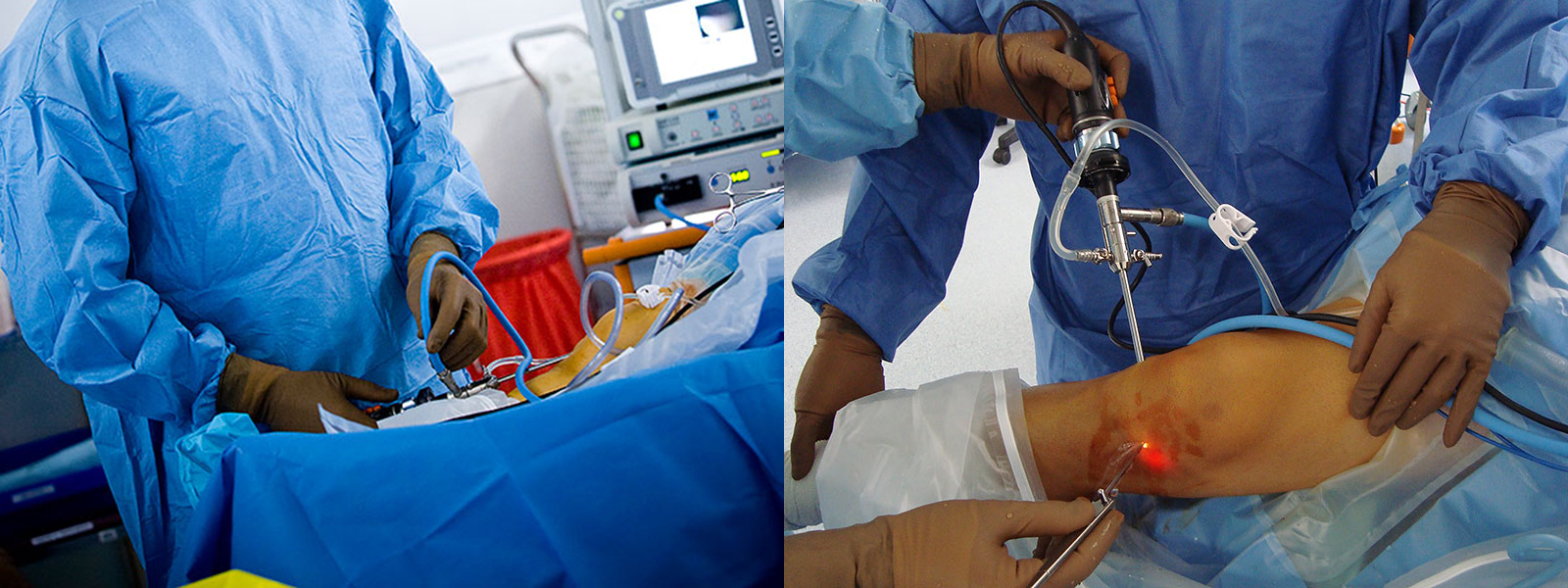 shoulder-arthroscopy